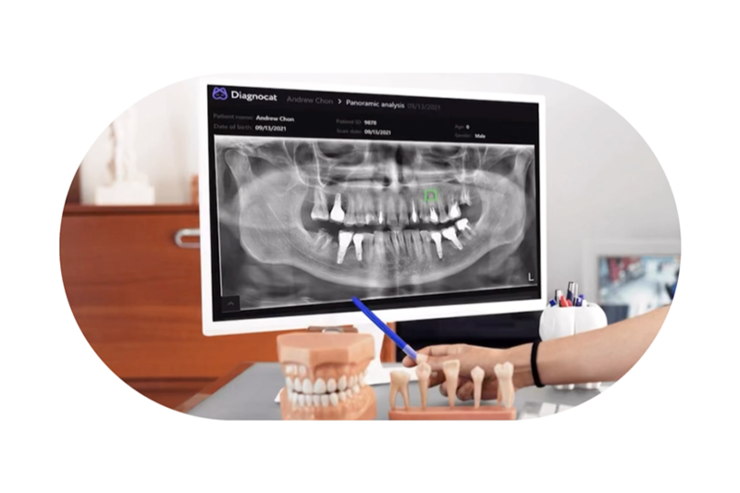 AI 齿科成像技术在加拿大获批，可识别三十余种齿科疾病